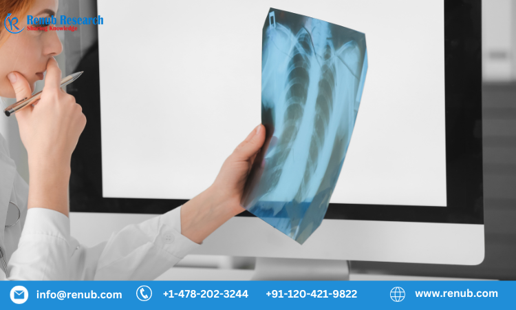 Lung Cancer Screening Market, Growth & Forecast 2028