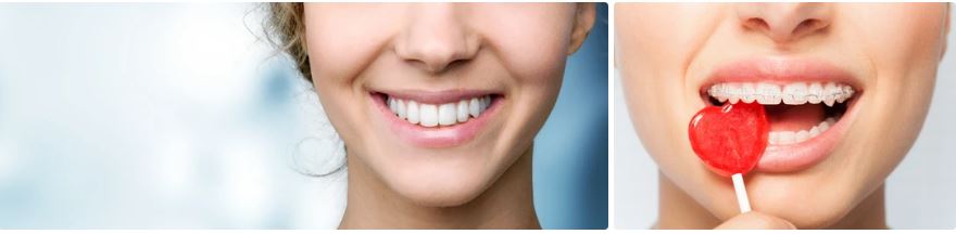 Teeth |  Youngsters Matured 3 Years And Are More Seasoned | Care 