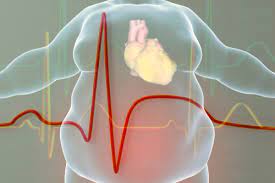 The Transformative Effects of Weight Loss on Cardiovascular Patients