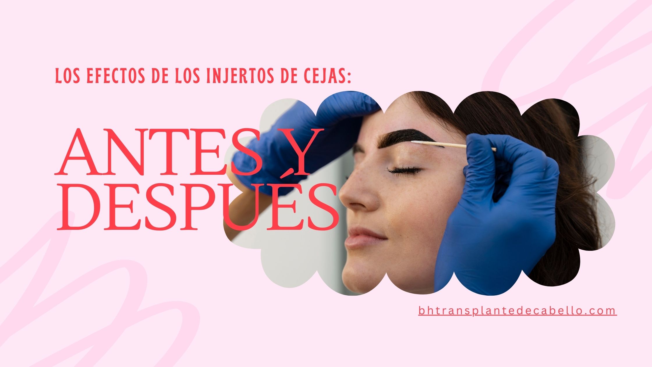 Injerto de Cejas Precio: Resalta tu Belleza Natural