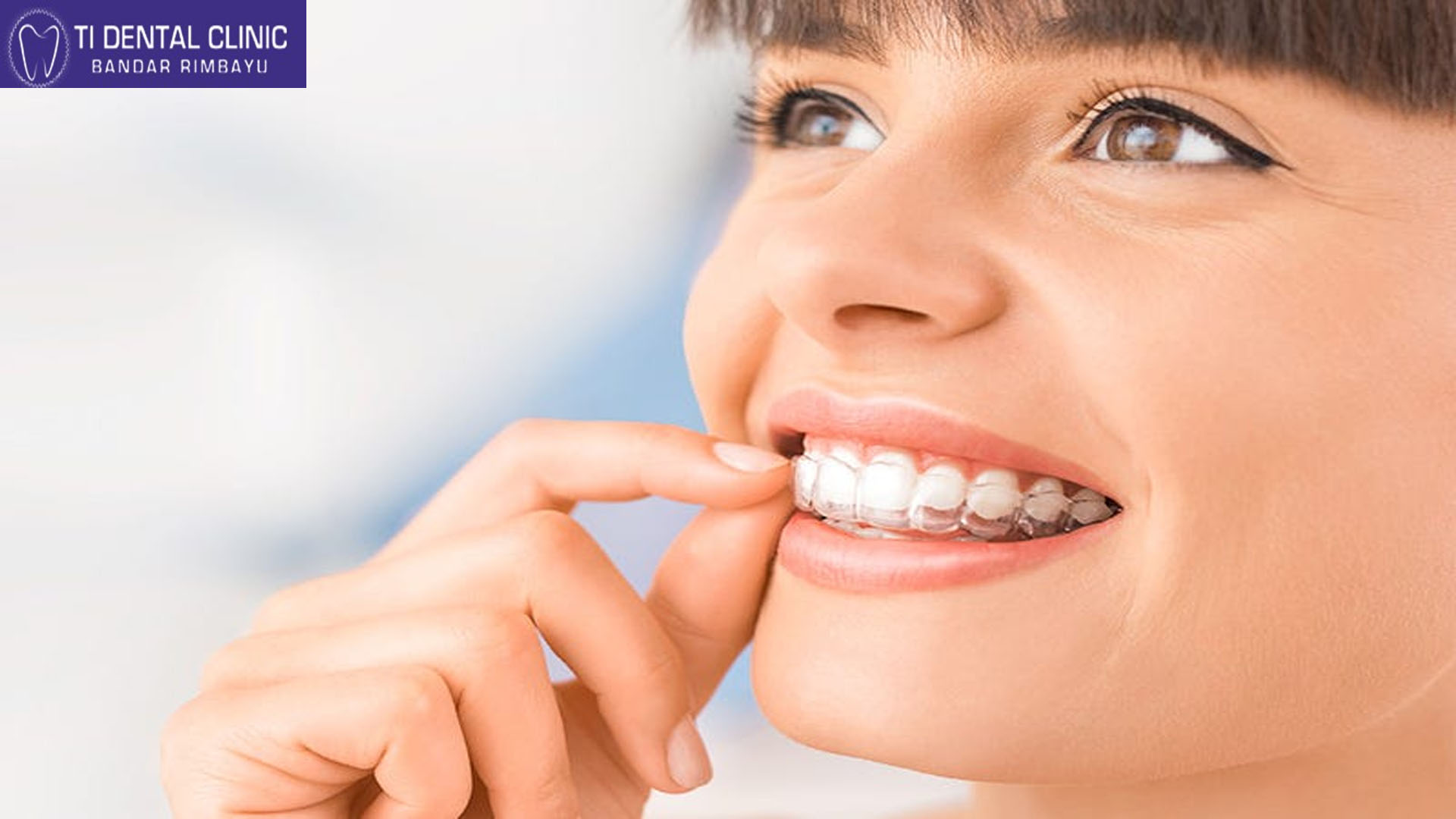 Invisible Braces Dentist: Aligning Teeth Discreetly and Effectively (Tidental)